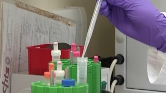 Cambridge University researchers believe that a pot of yoghurt a day may help prevent diabetes.