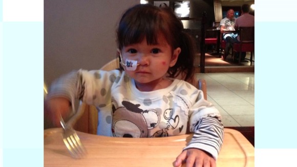 A combination of her rare conditions and an unusual heritage means finding a match is difficult