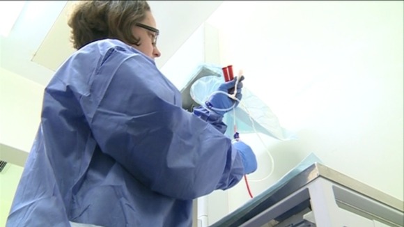 umbilical cord extraction