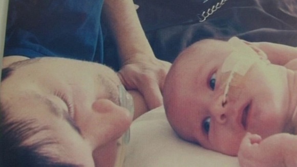 Maison had to undergo chemotherapy just a few days into his life.