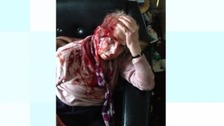 Pensioner speaks after assault in Totterdown home