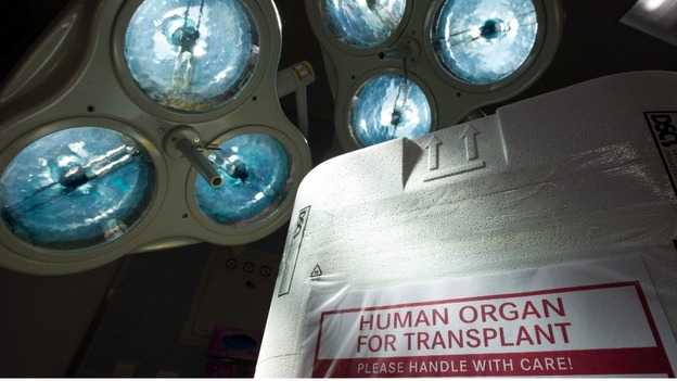 Transplant