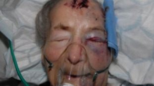 93 year old Emma Winnall who was found badly beaten in her bed in Moseley earlier this month – has passed away in hospital this morning.