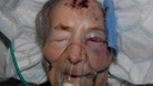 93 year old Emma Winnall who was found badly beaten in her bed in Moseley earlier this month – has passed away in hospital this morning.