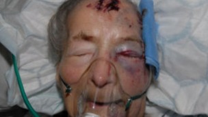 93 year old Emma Winnall who was found badly beaten in her bed in Moseley earlier this month – has passed away in hospital this morning.