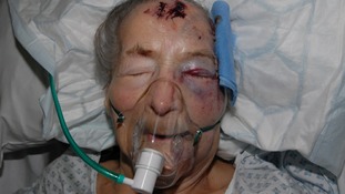 93-year-old Emma Winnall had been in intensive care since May 1.