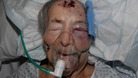 93-year-old Emma Winnall had been in intensive care since May 1.