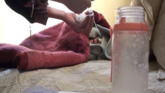 Wala'a's mother now feeds her precious drops of powdered milk through a tube.