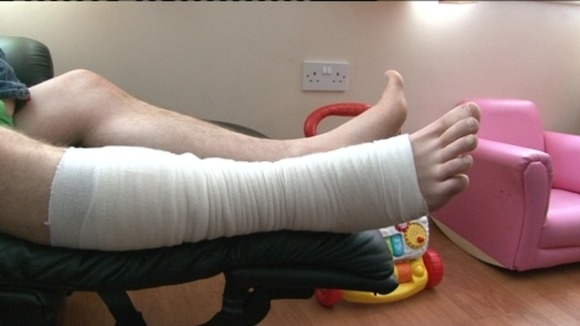 Jamie's bone was visible after being bitten