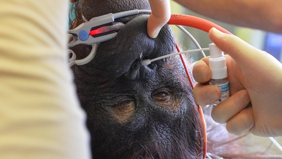 Orangutan on operating table