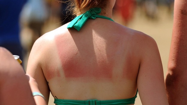 Skin cancer rates have soared since the seventies, Cancer Research UK says.