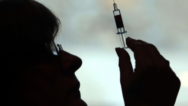 Smear test