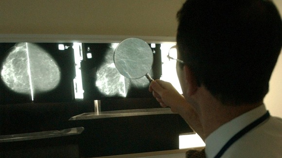 A quarter of women miss screening appointments