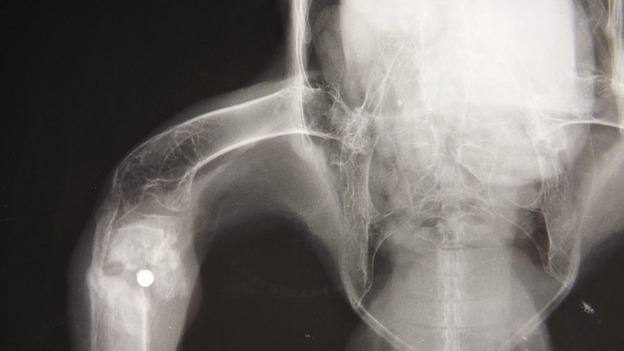 X-ray showing Red Kite's shotgun injuries