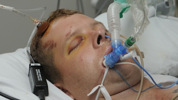 Darren Wyatt in hospital