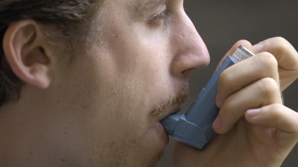 Asthma