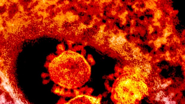 Middle East Respiratory Syndrome