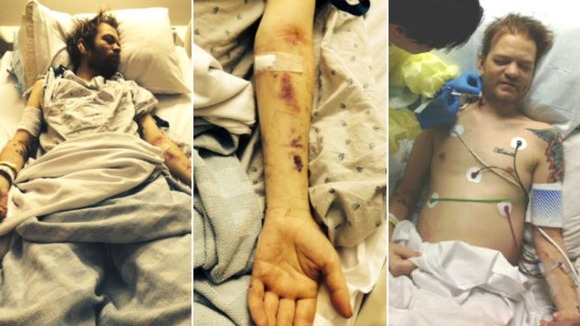 Dereck Whibley spent a month in hospital after his liver and kidneys collapsed due to alcohol abuse.