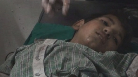 The boy lost both his parents during the conflict.