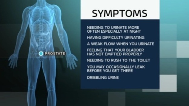 Image result for symptoms of prostate problems