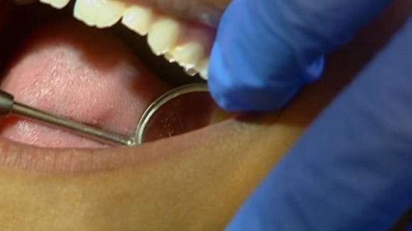Teeth