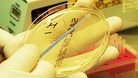 Legionnaires' Disease