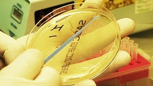 Legionnaires' Disease