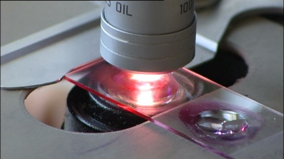 There have been 21 confirmed and 19 suspected cases of Legionnaires' disease in Edinburgh