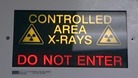 X Ray