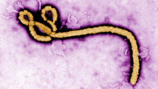 Colourised transmission electron micrograph reveals some of the morphology displayed by an Ebola virus.