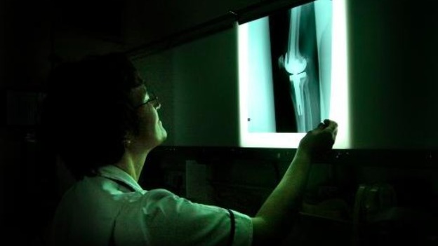 Shot of nurse looking at x ray