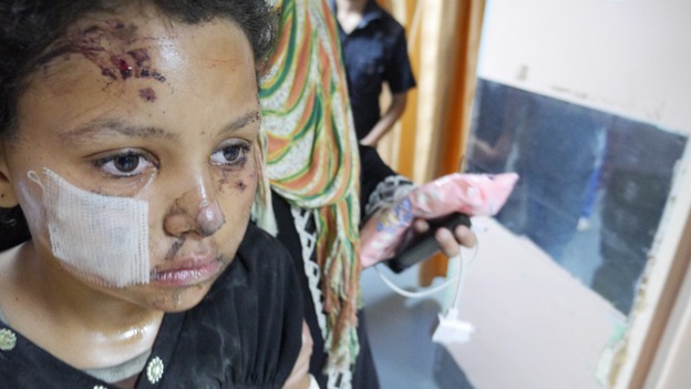 The conflict has seen children on both sides injured and killed.