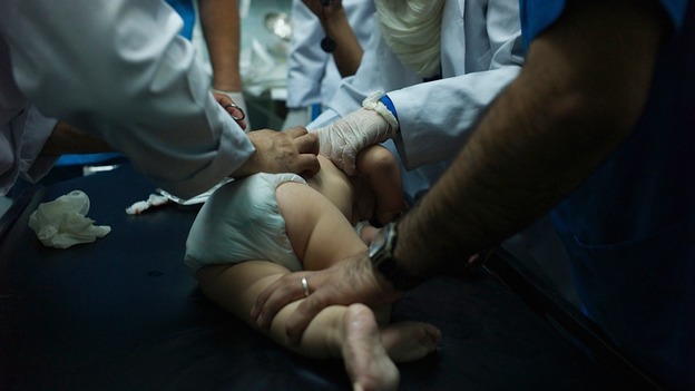 A three month old baby is treated for schrapnel wounds.
