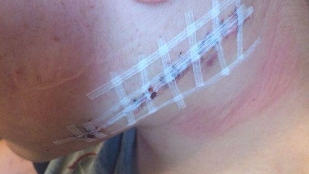 Margaret Finn posted a picture of her son after he was attacked in Pimlico