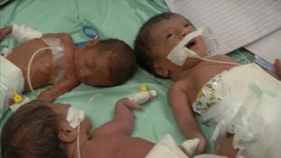 Three premature babies have to share an incubator as resources are stretched.