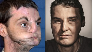 Richard Norris' dramatic transformation began in 2012.