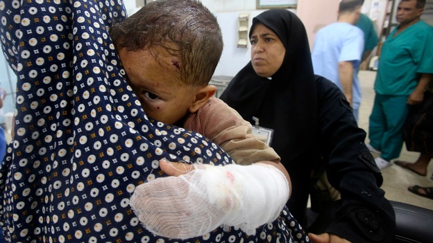 A Palestinian women holders her grandson who medics say was wounded in an Israeli airstrike at a hospital in Khan Younis.