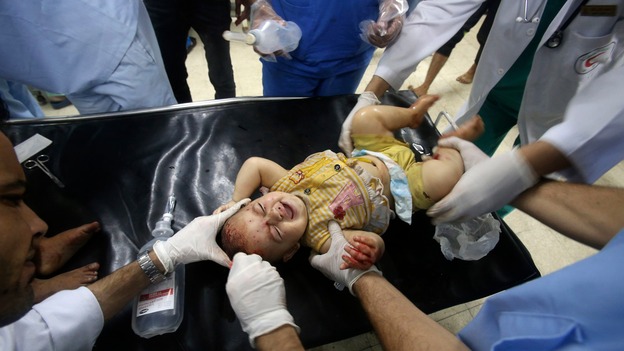 A baby is treated for shrapnel wounds after being hit by an airstrike in Khan Younis