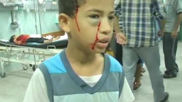 Children were treated at a hospital in Gaza.