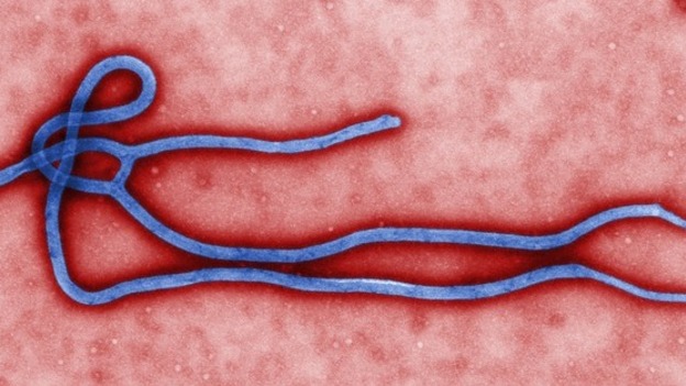 A microscopic view of the Ebola virus.