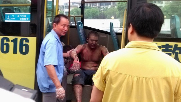 An injured man is helped by a rescue worker after the massive explosion.