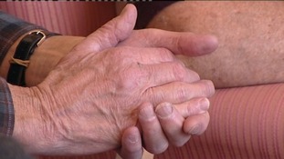 Arthritis, knuckles