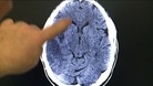 brain scan