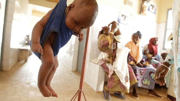 A baby girl is weighed in a sling scale at the Bilmari health centre in the town of Mirriah.
