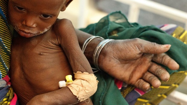 Nineteen-month-old Raya Kabirou, who is severely malnourished, sits in her grandmother’s lap, at the UNICEF-supported Mirriah District Hospital.