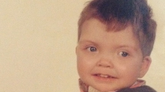 Three year old Reece requires constant care