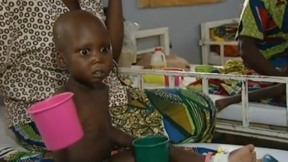 A child in a West African hospital.