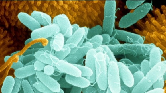 Pseudomonas bacteria
