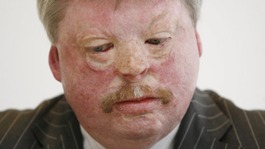 Simon Weston