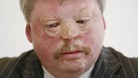 Simon Weston